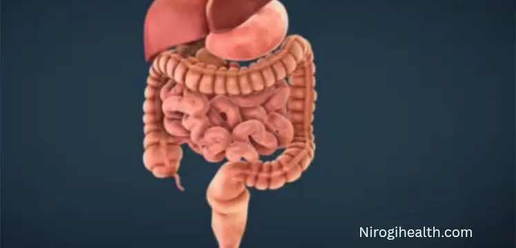 अपेंडिक्स का रामबाण इलाज | लक्षण | कारण | Appendix treatment|in hindi