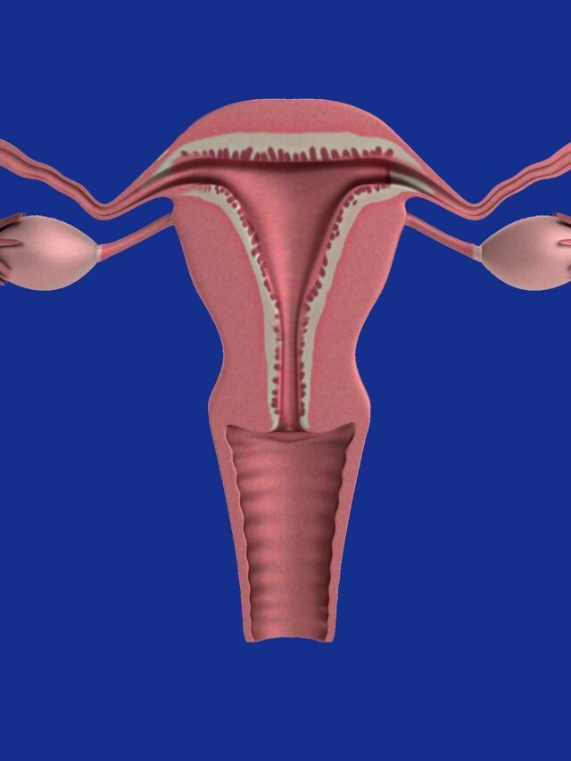 पॉलीसिस्टिक ओवरी सिंड्रोम क्या है