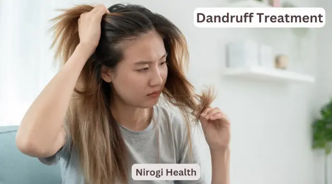 Dandruff treatment