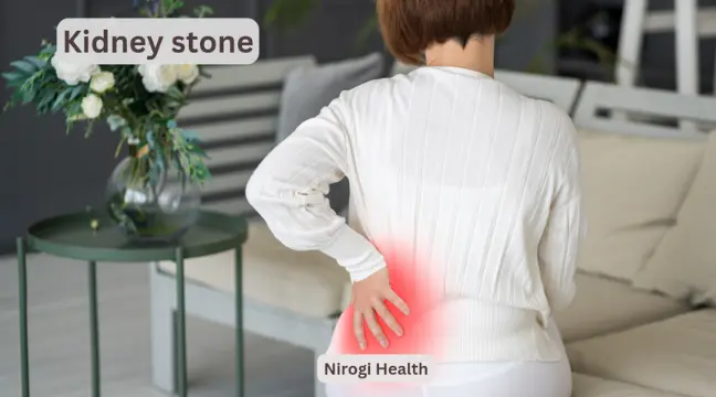 Kidney stone treatment in hindi