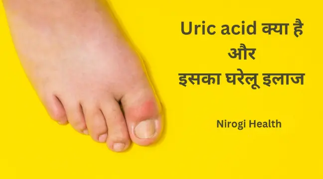 Uric acid treatment